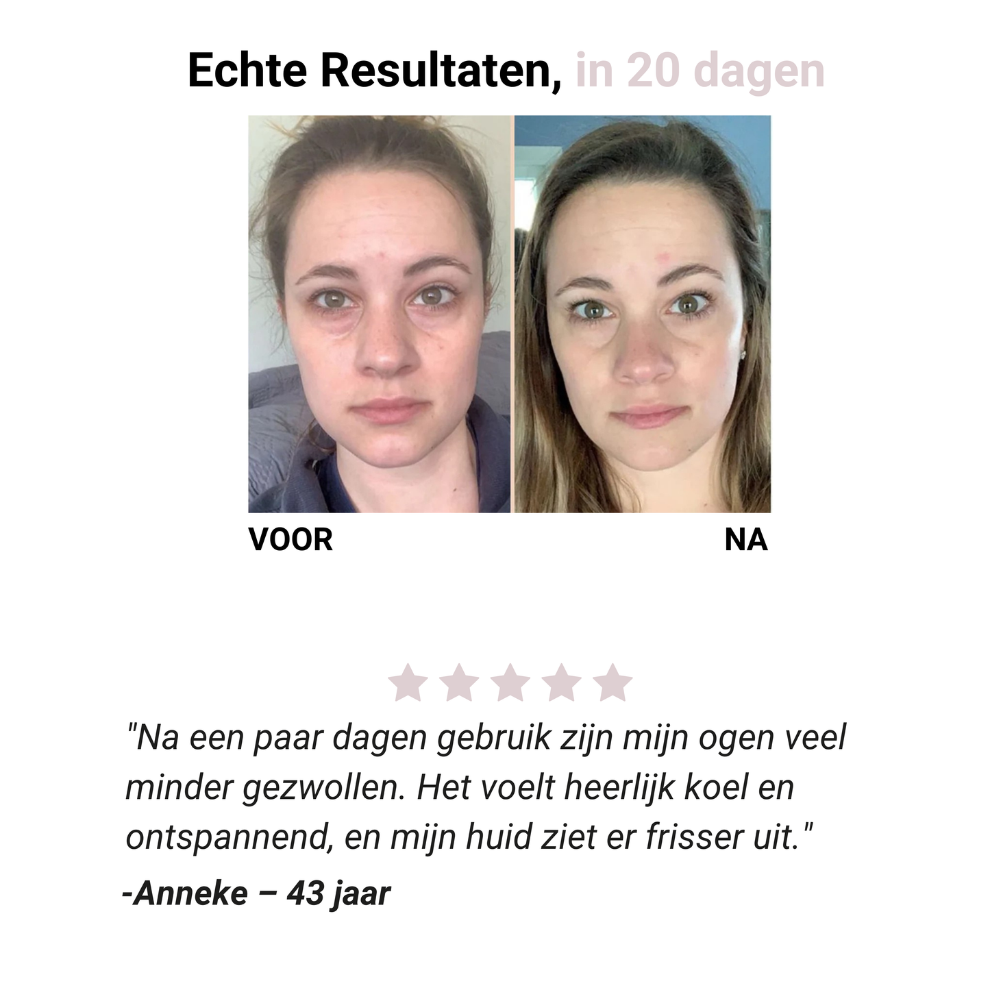 Eye Lifting Massager - Verhelderende & Verstevigende Gezichtsactivator