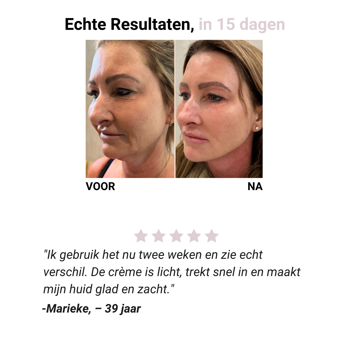 Eye Lifting Massager - Verhelderende & Verstevigende Gezichtsactivator