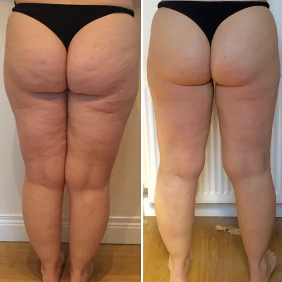 Before/After 1