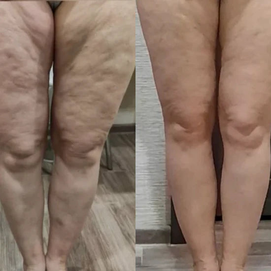 Before/After 3