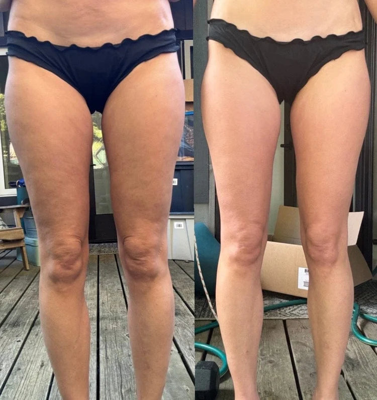 Before/After 2