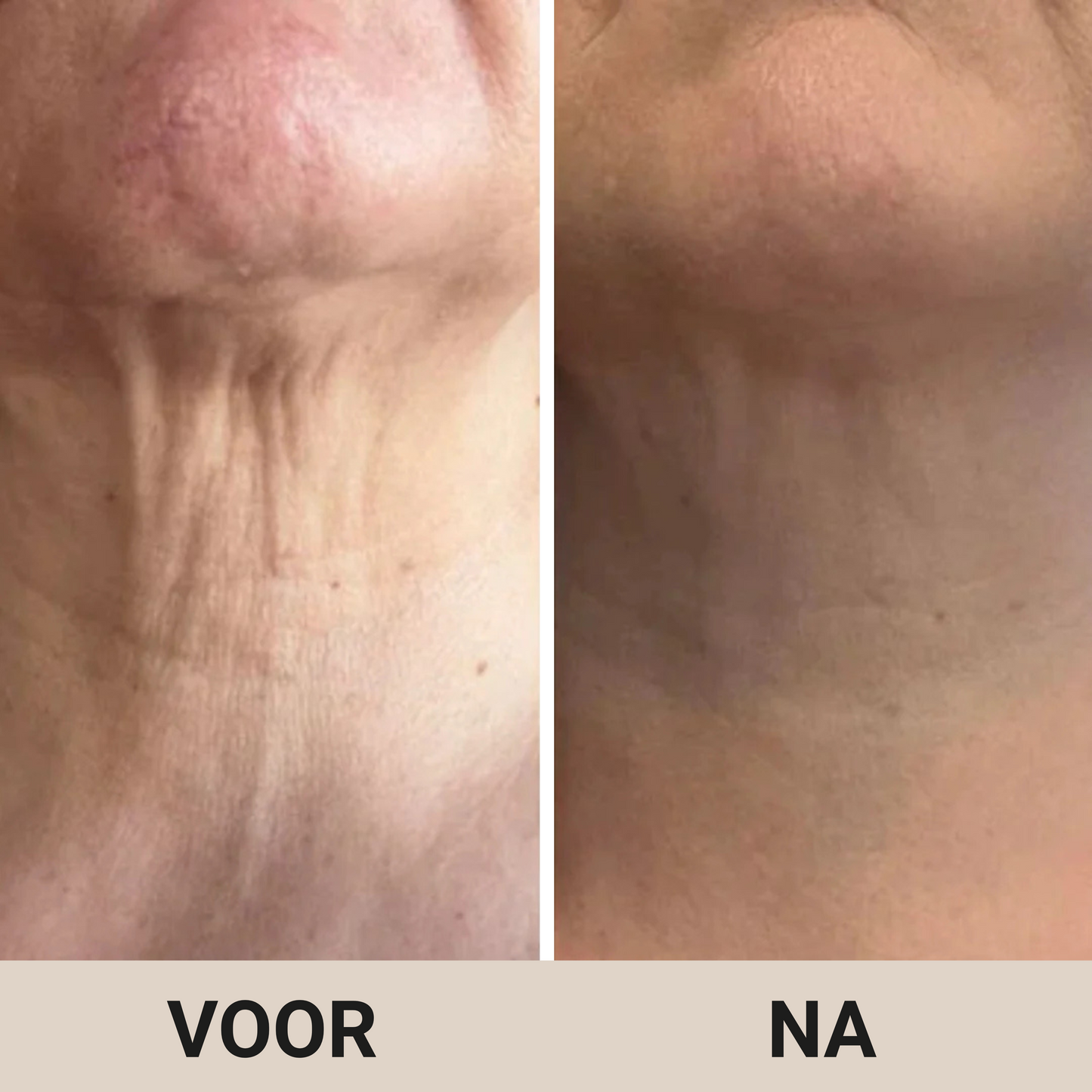 Firming - Verstevigende Crème voor de Hals