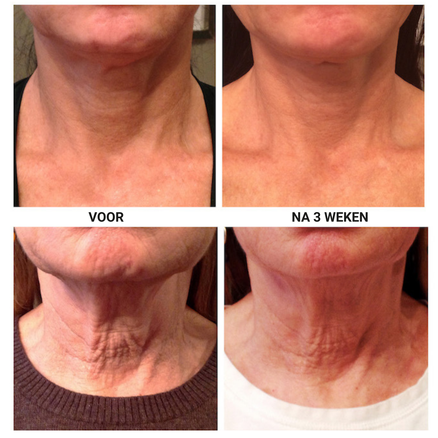 Firming - Verstevigende Crème voor de Hals