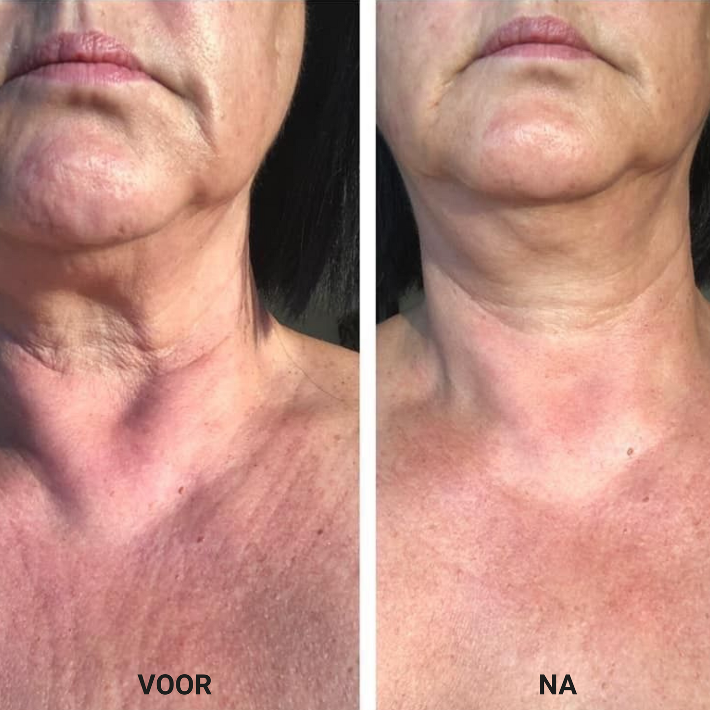 Firming - Verstevigende Crème voor de Hals