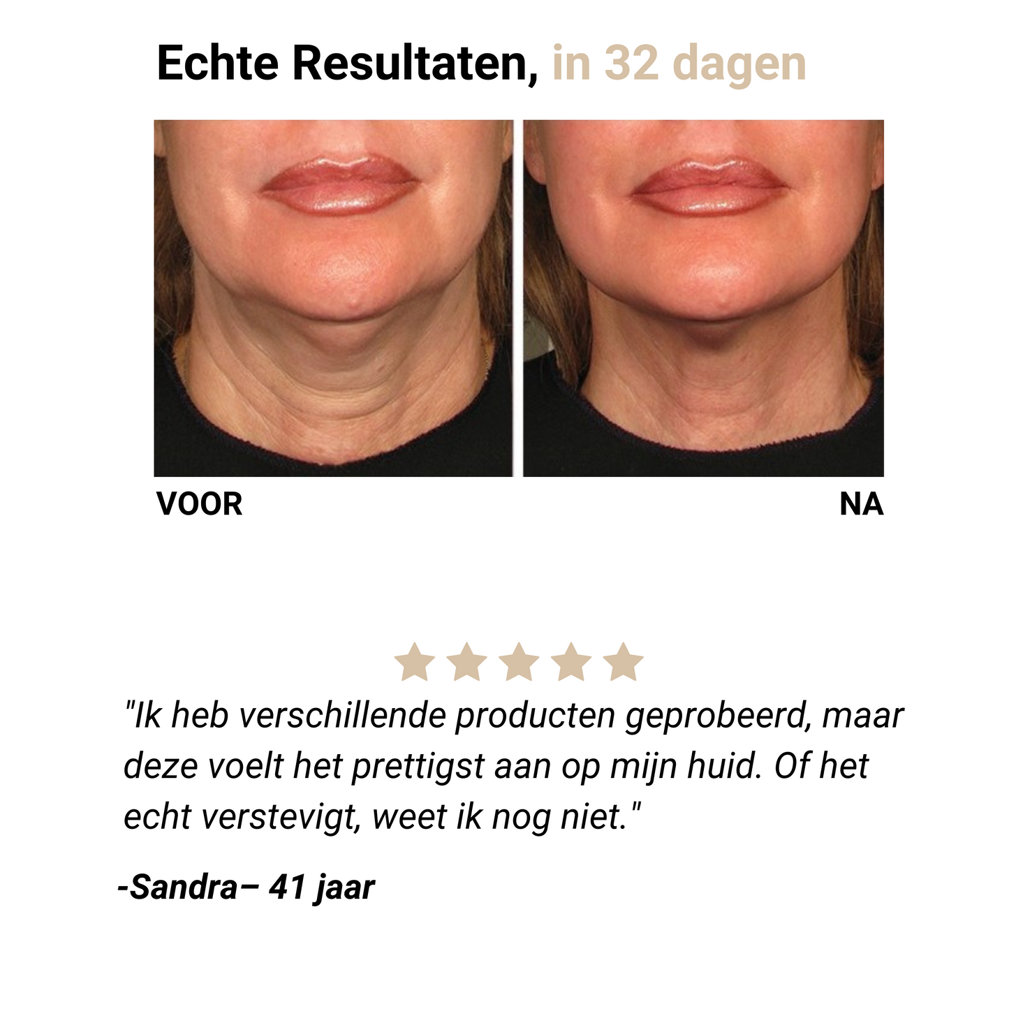 Firming - Verstevigende Crème voor de Hals