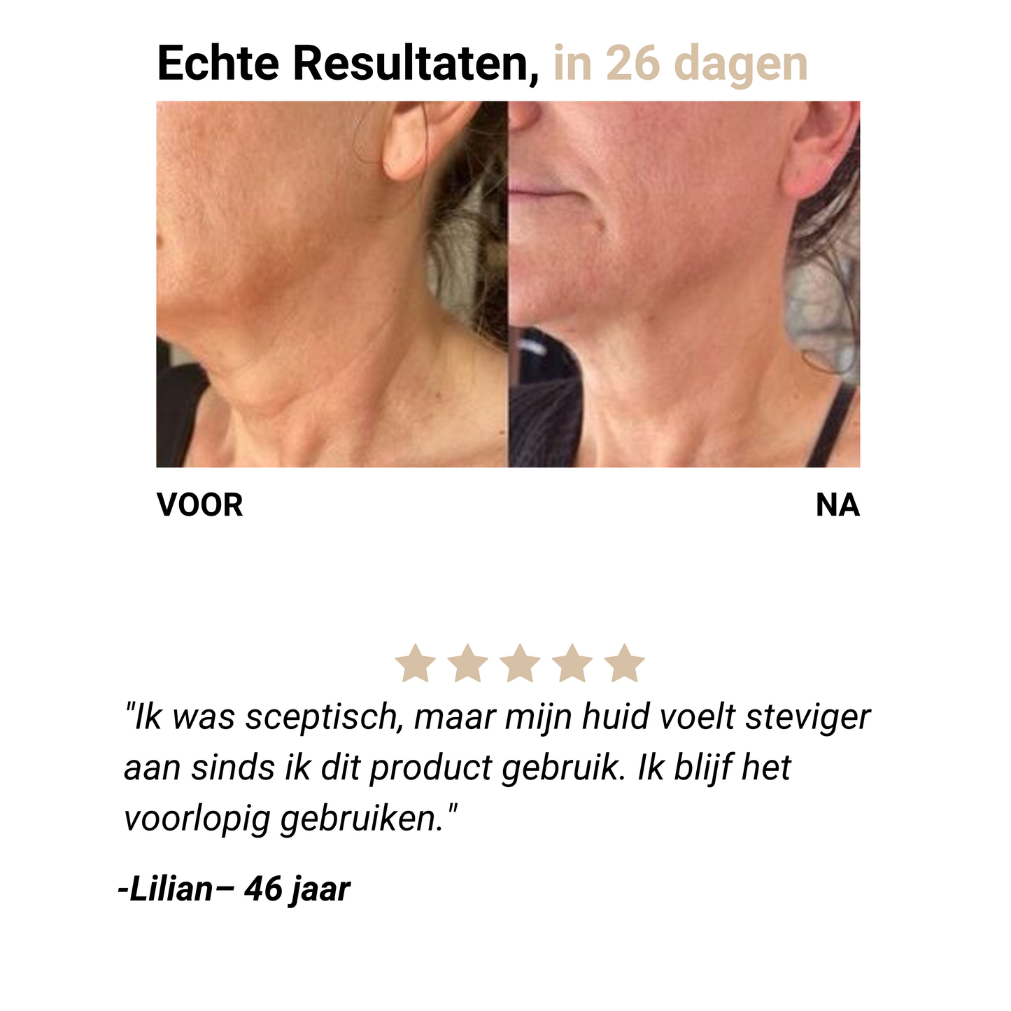 Firming - Verstevigende Crème voor de Hals