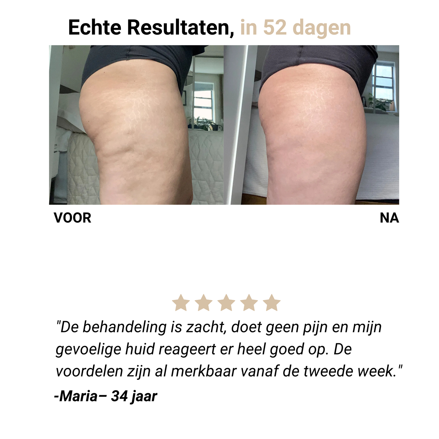 Selena® – Anti-Cellulite Massager voor Gladde Huid