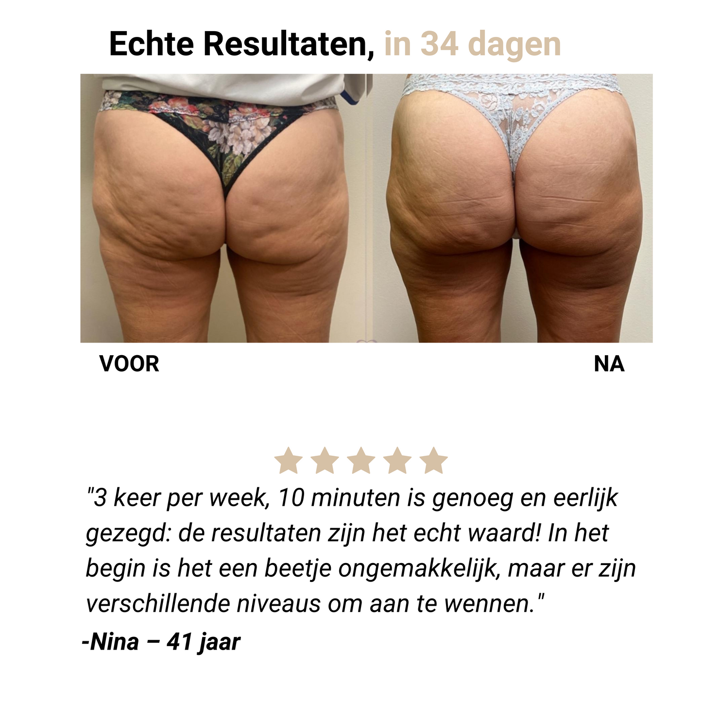 Selena® – Anti-Cellulite Massager voor Gladde Huid