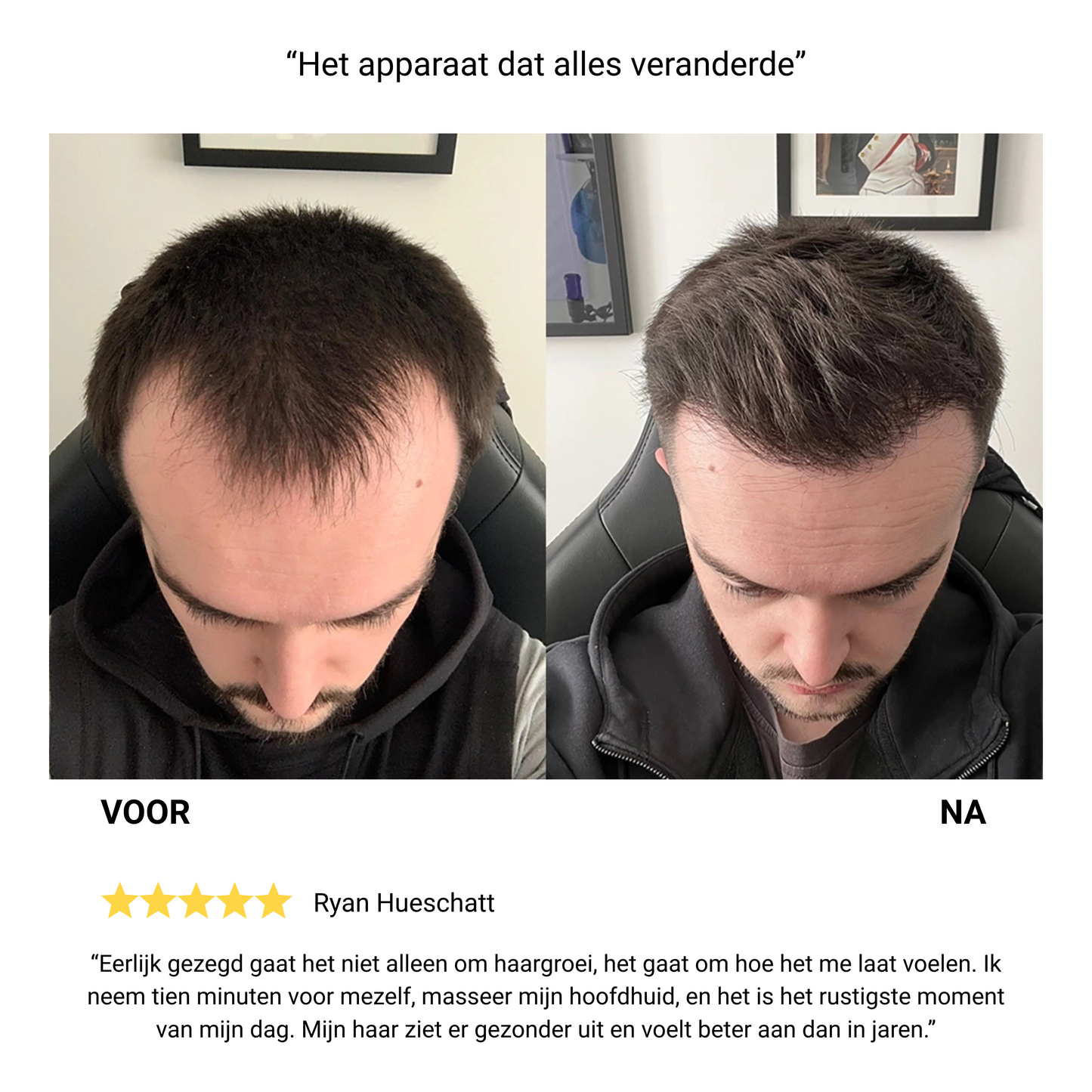 Voltra® – Haargroei stimulerende UV-technologie