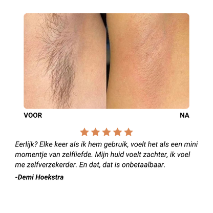 Glans & Zacht Gezichtsraser® – Pijnloos & Zonder Irritatie