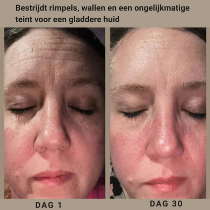 Arina® | Retinoïde Nachtcrème voor Gladde en Heldere Huid