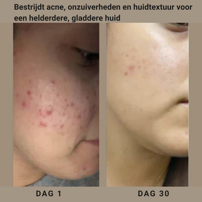 Arina® | Retinoïde Nachtcrème voor Gladde en Heldere Huid